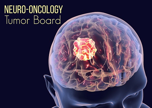 2024 EDW Multidisciplinary Neuro Oncology Tumor Board (RSS) Banner
